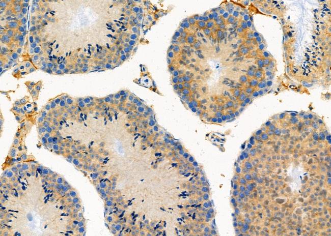 GAS2L1 Antibody in Immunohistochemistry (Paraffin) (IHC (P))