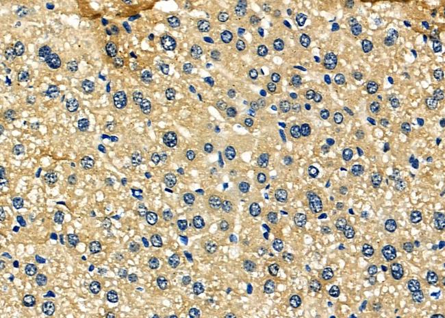 SCCPDH Antibody in Immunohistochemistry (Paraffin) (IHC (P))