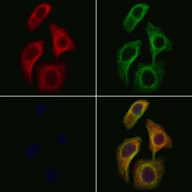 SPINLW1 Antibody in Immunocytochemistry (ICC/IF)