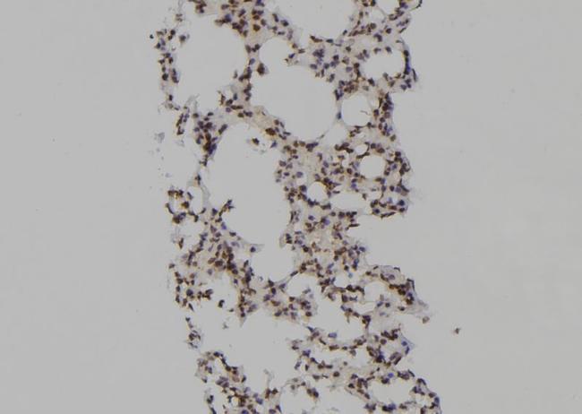 PSMA6 Antibody in Immunohistochemistry (Paraffin) (IHC (P))