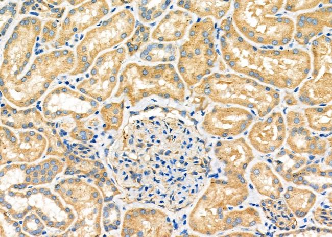 MRP4 Antibody in Immunohistochemistry (Paraffin) (IHC (P))