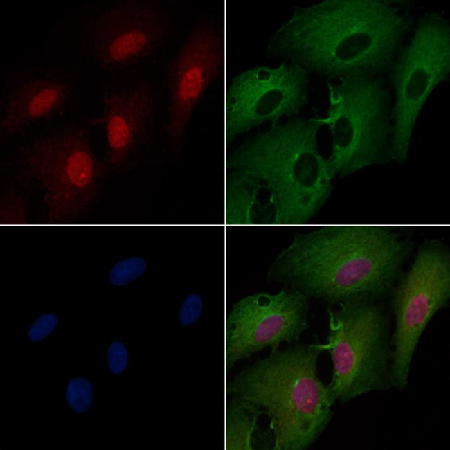 MDA5 Antibody in Immunocytochemistry (ICC/IF)