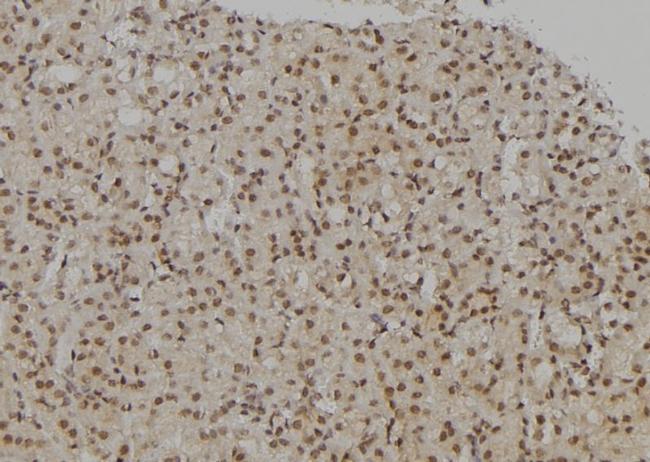 UHRF2 Antibody in Immunohistochemistry (Paraffin) (IHC (P))