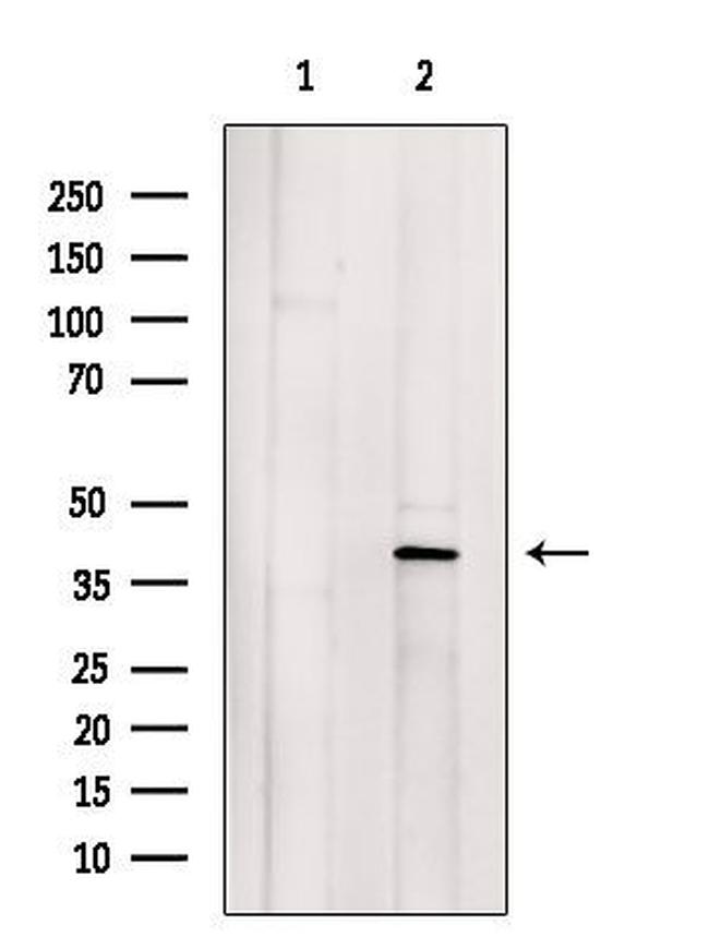 GNAO1 Antibody in Western Blot (WB)