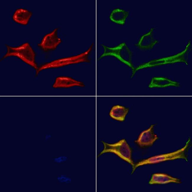 PCBP2 Antibody in Immunocytochemistry (ICC/IF)