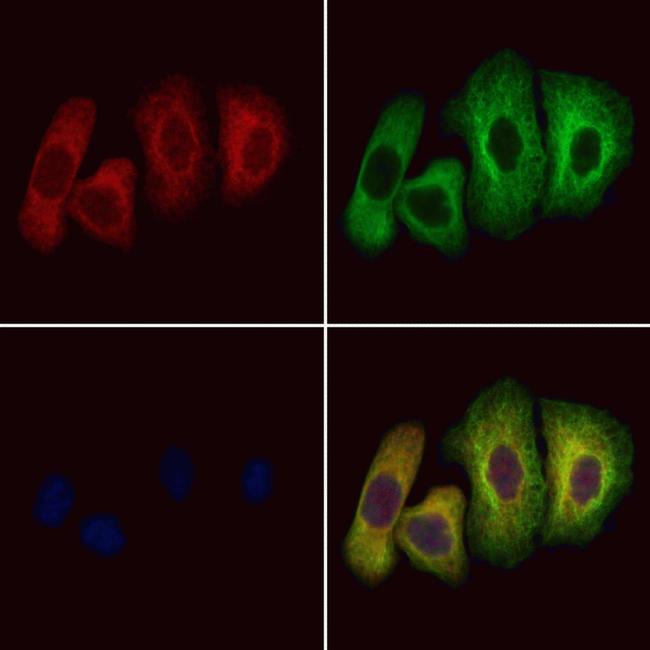 PRG2 Antibody in Immunocytochemistry (ICC/IF)