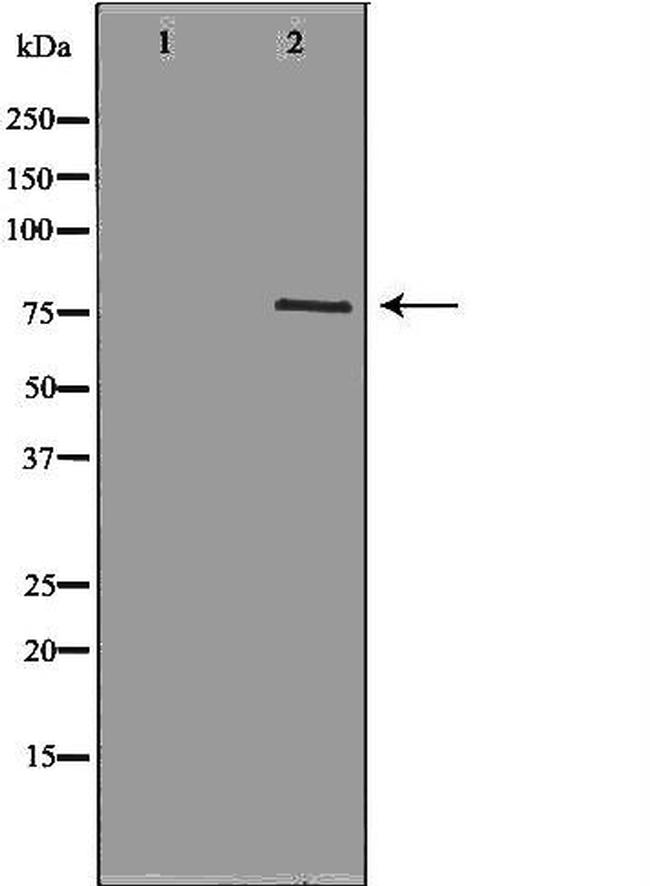 cGKI Antibody in Western Blot (WB)