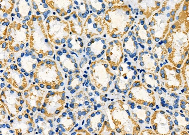 ALDH4A1 Antibody in Immunohistochemistry (Paraffin) (IHC (P))