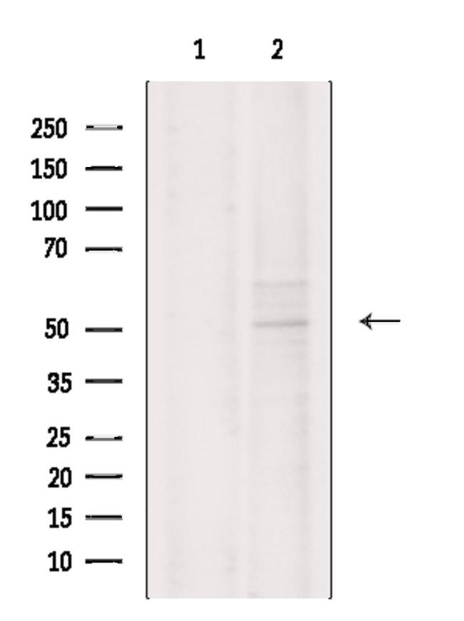 CNTFR Antibody in Western Blot (WB)