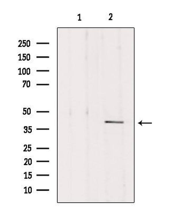 DLK1 Antibody in Western Blot (WB)