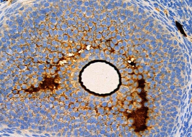 VMAT2 Antibody in Immunohistochemistry (Paraffin) (IHC (P))