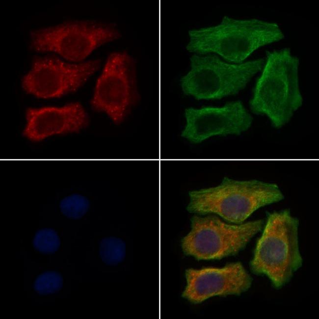 LAMP3 Antibody in Immunocytochemistry (ICC/IF)