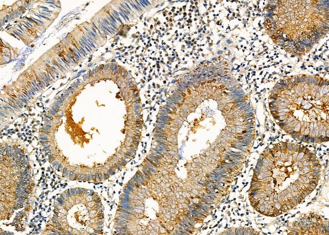 Kallikrein 2 Antibody in Immunohistochemistry (Paraffin) (IHC (P))