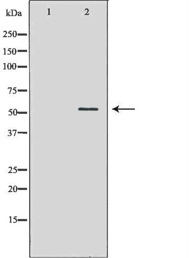 KV1.1 (KCNA1) Antibody in Western Blot (WB)