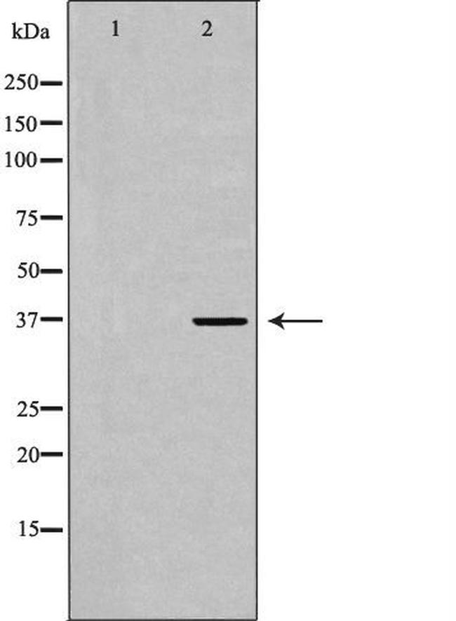 MC5R Antibody in Western Blot (WB)