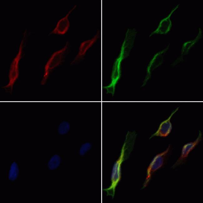 MRP5 Antibody in Immunocytochemistry (ICC/IF)