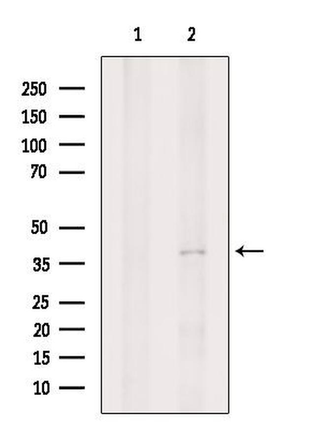 P2Y11 Antibody in Western Blot (WB)