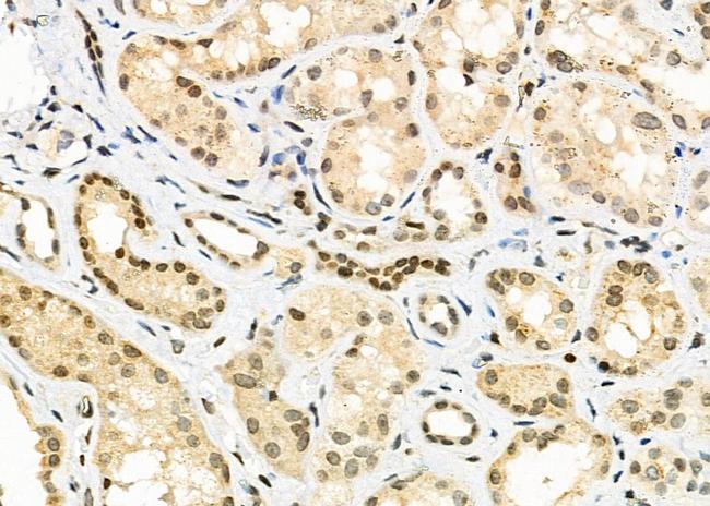 Gemin 2 Antibody in Immunohistochemistry (Paraffin) (IHC (P))