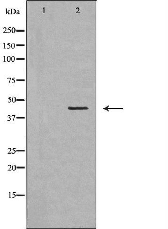 TCF7 Antibody in Western Blot (WB)