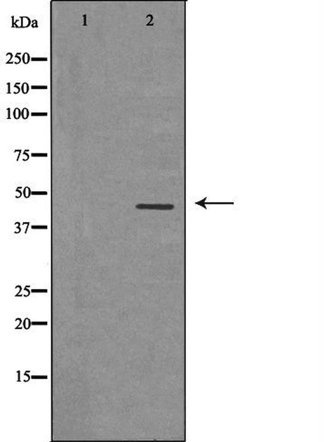 NPY1R Antibody in Western Blot (WB)