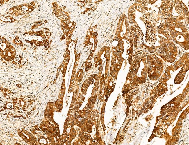 SLC22A8 Antibody in Immunohistochemistry (Paraffin) (IHC (P))