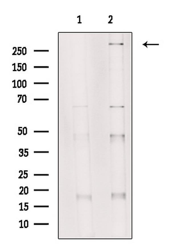 SETD2 Antibody in Western Blot (WB)