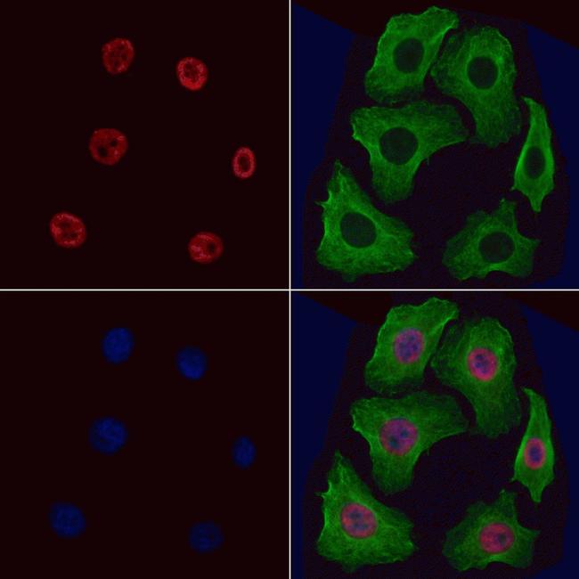 NONO Antibody in Immunocytochemistry (ICC/IF)