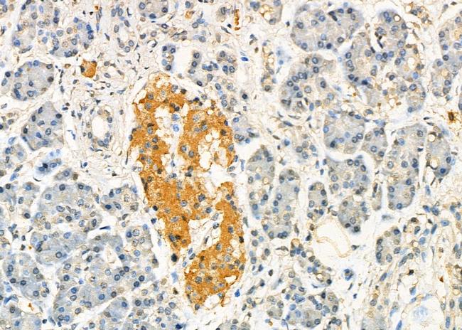 PEO1 Antibody in Immunohistochemistry (Paraffin) (IHC (P))