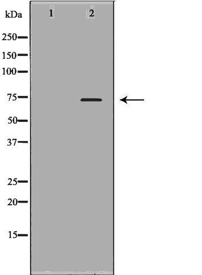 Plasma Kallikrein Antibody in Western Blot (WB)