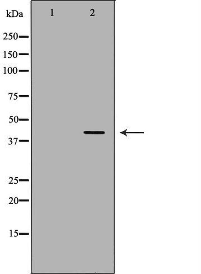 PKA beta Antibody in Western Blot (WB)