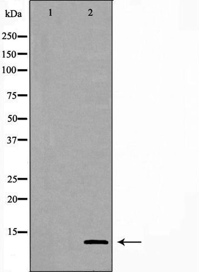 GHRH Antibody in Western Blot (WB)