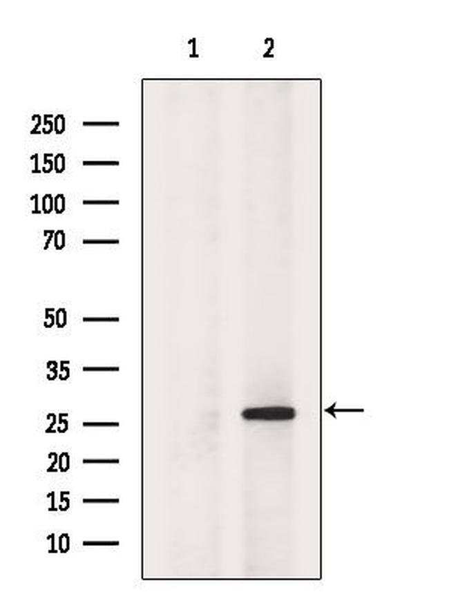 HDGF Antibody in Western Blot (WB)