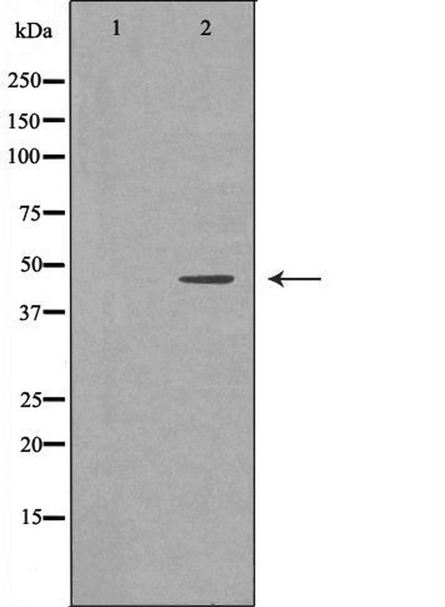 HFE2 Antibody in Western Blot (WB)