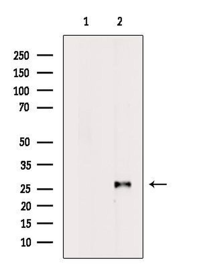 VAPB Antibody in Western Blot (WB)