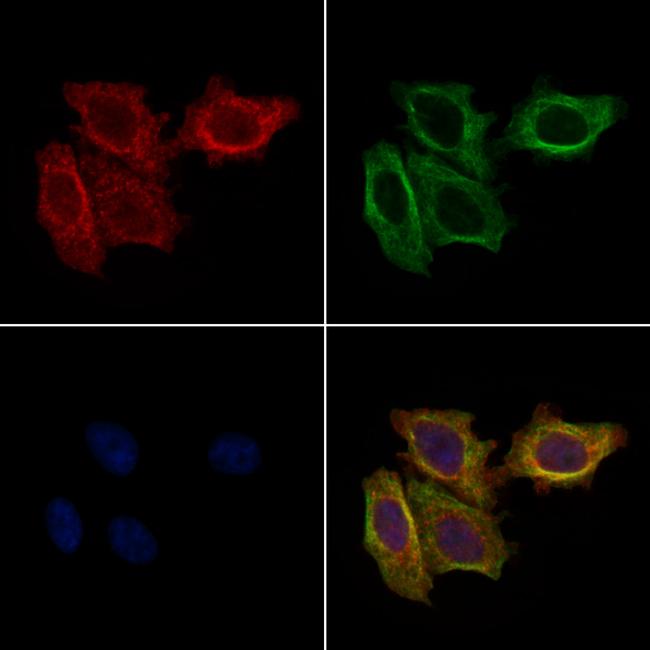 FBP1 Antibody in Immunocytochemistry (ICC/IF)