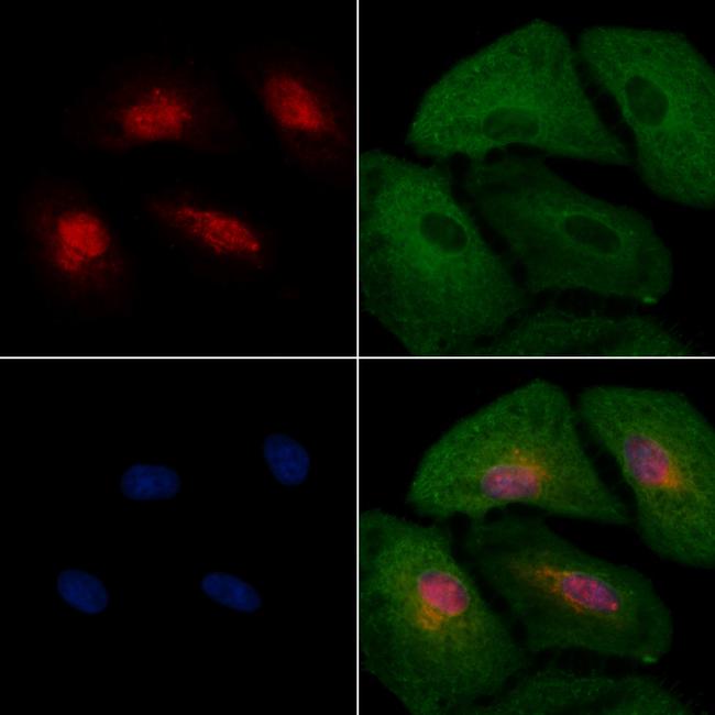 HEC1 Antibody in Immunocytochemistry (ICC/IF)