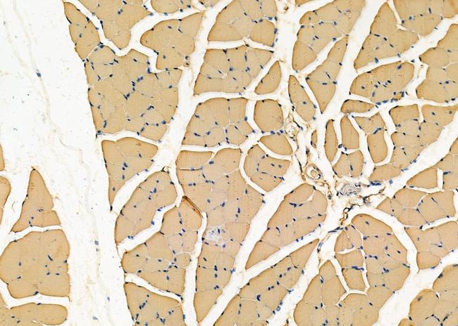 PCCB Antibody in Immunohistochemistry (Paraffin) (IHC (P))