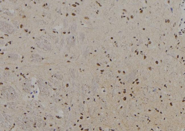 PFKM Antibody in Immunohistochemistry (Paraffin) (IHC (P))