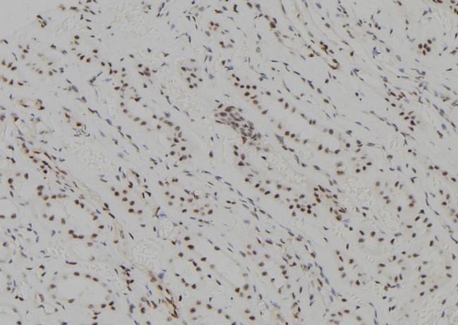 UBE2C Antibody in Immunohistochemistry (Paraffin) (IHC (P))