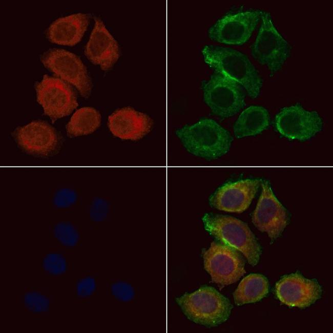 KLC1 Antibody in Immunocytochemistry (ICC/IF)