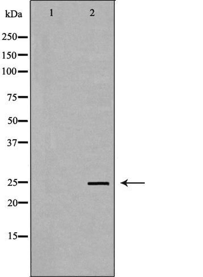 TK1 Antibody in Western Blot (WB)