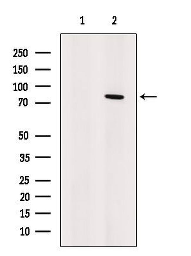 Artemis Antibody in Western Blot (WB)