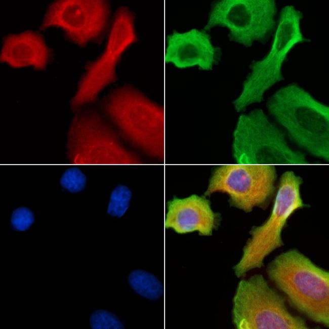 HEXA Antibody in Immunocytochemistry (ICC/IF)