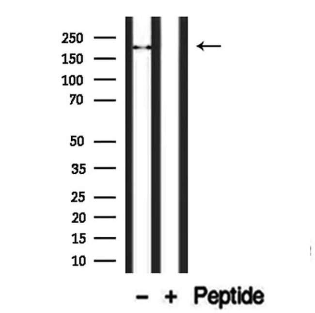 TRPM2 Antibody in Western Blot (WB)