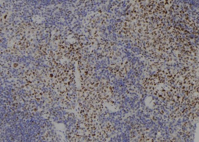 SMC3 Antibody in Immunohistochemistry (Paraffin) (IHC (P))