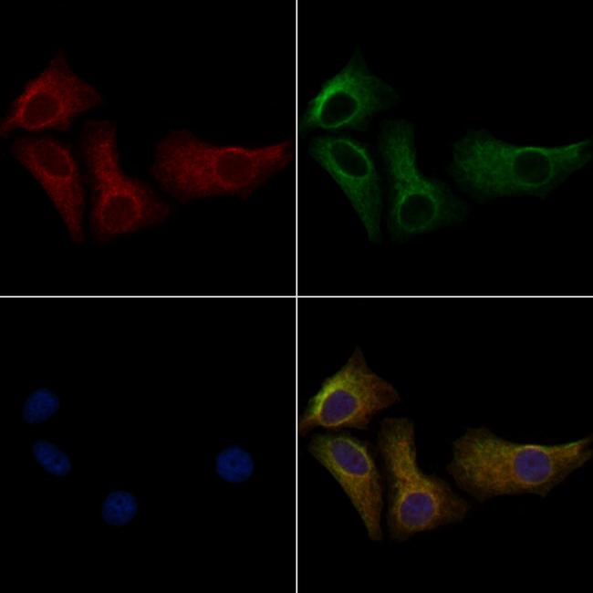 Phospho-PERK (Thr982) Antibody in Immunocytochemistry (ICC/IF)