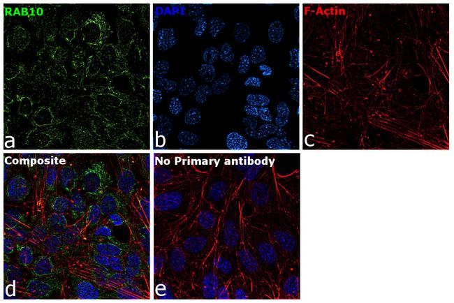 RAB10 Antibody in Immunocytochemistry (ICC/IF)