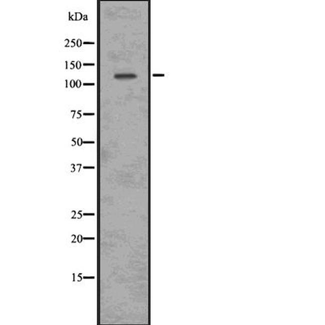 Phospho-ULK1 (Ser556) Antibody in Western Blot (WB)