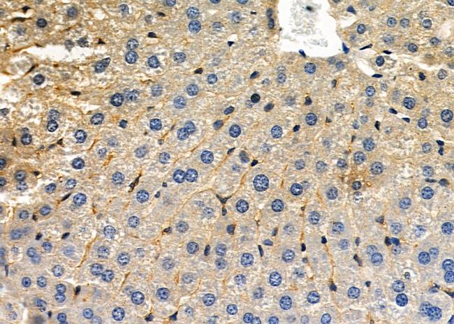 CLCN3 Antibody in Immunohistochemistry (Paraffin) (IHC (P))