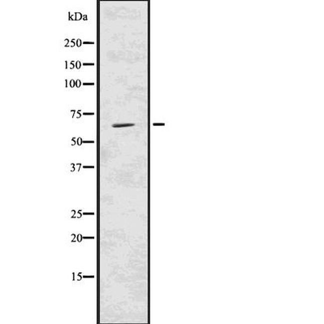 USP22 Antibody in Western Blot (WB)